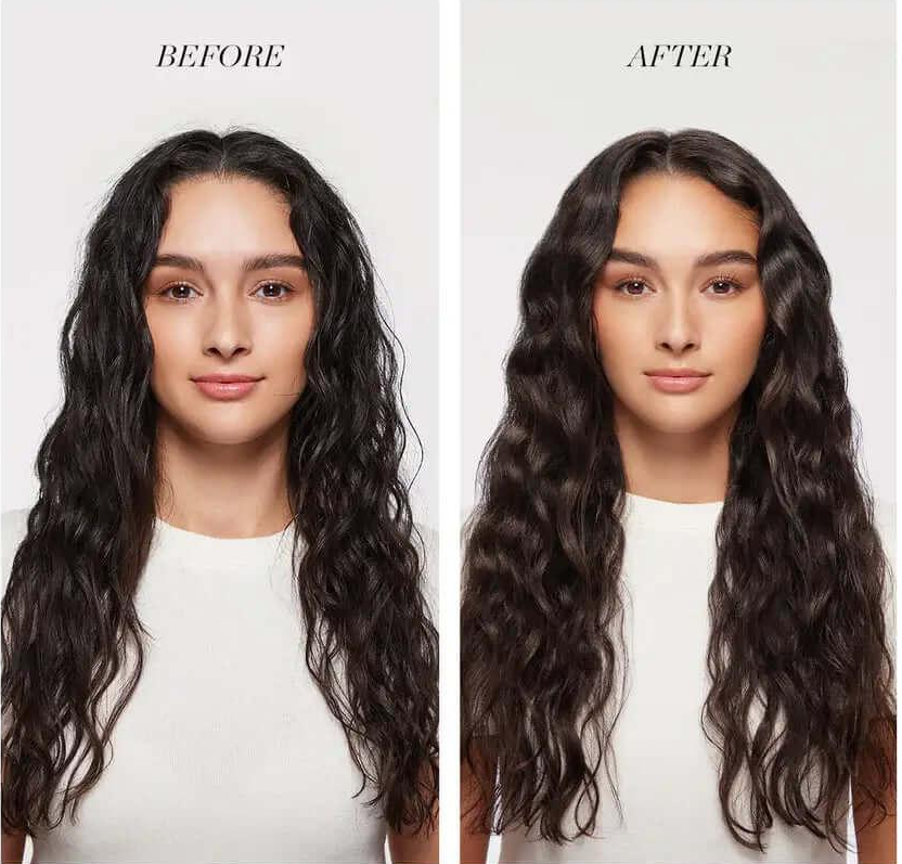 Scalp Therapy Roller – Stimola la Ricrescita e Rinforza i Capelli