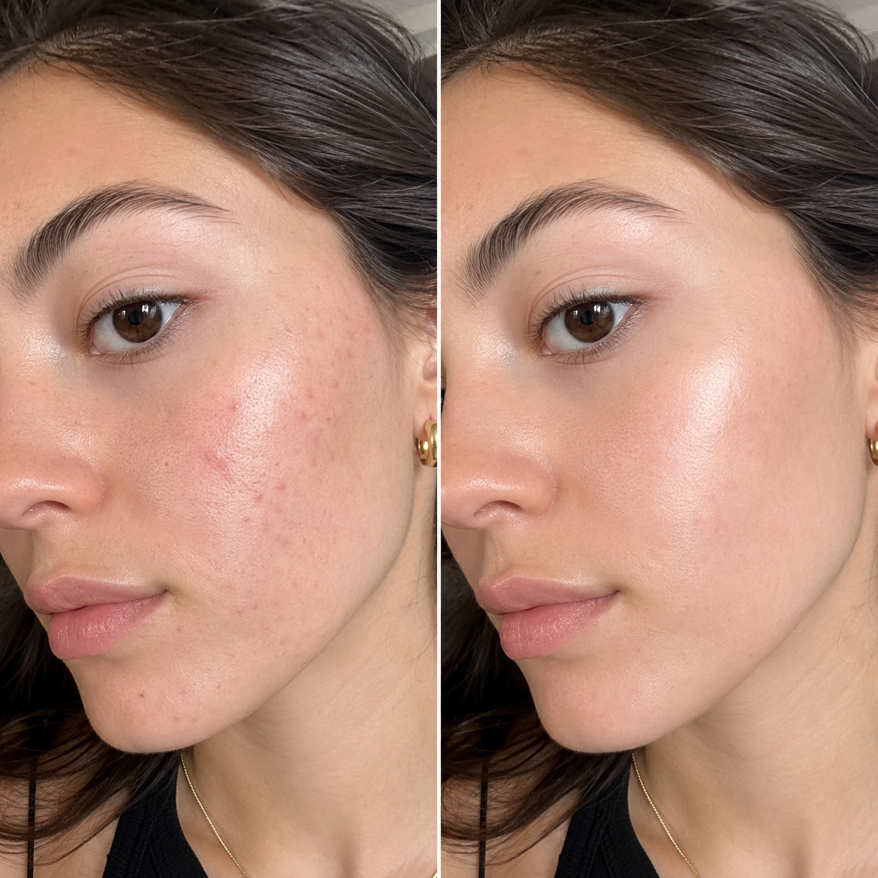 Esfoliante al riso - Siero Coreano EXFOLIANT RICE AMPOULE
