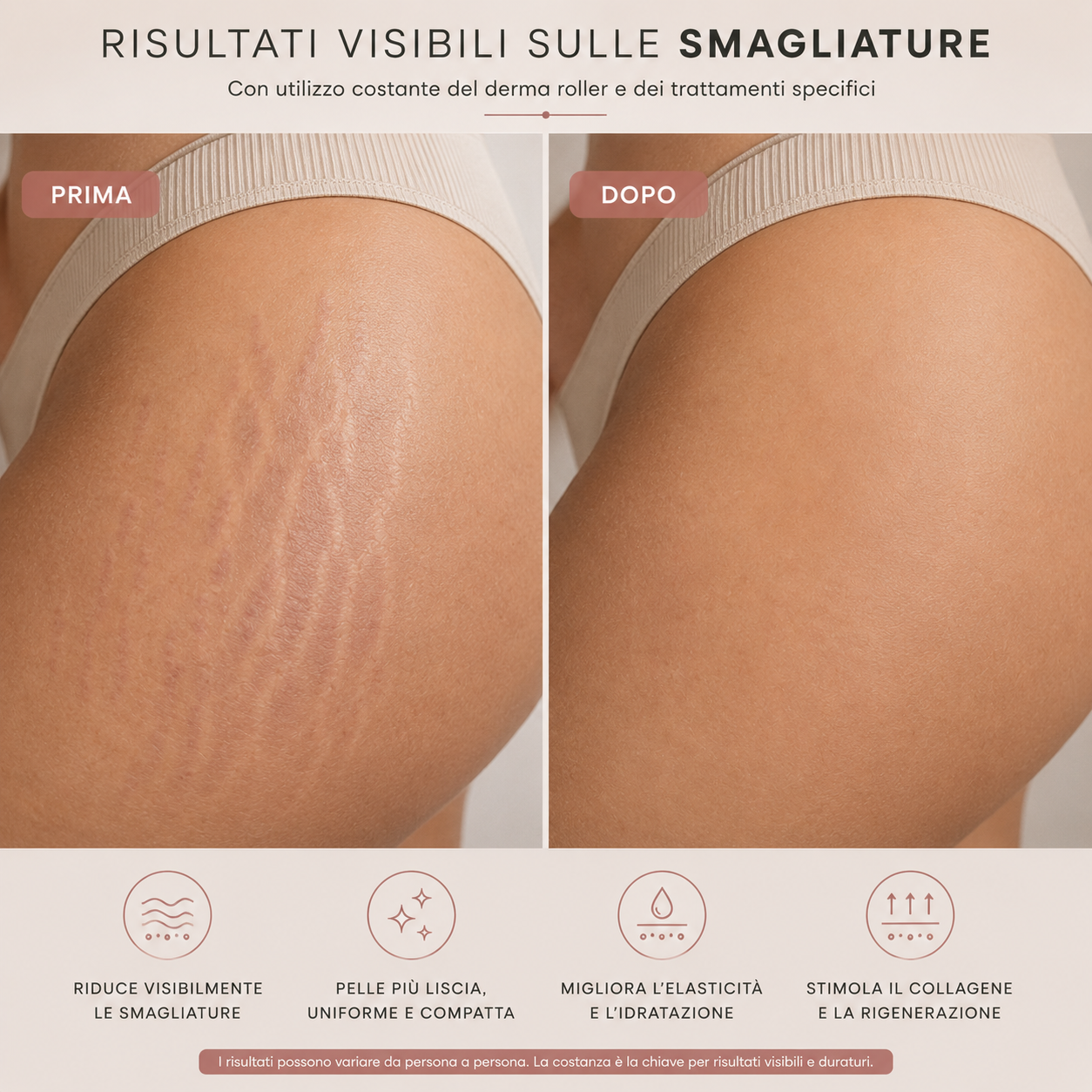 DERMA ROLLER™ – Un solo trattamento per smagliature, rughe e labbra